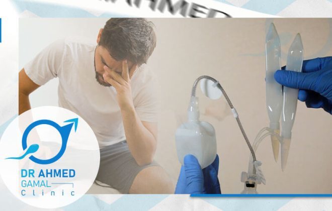تكلفة عملية دعامة الانتصاب