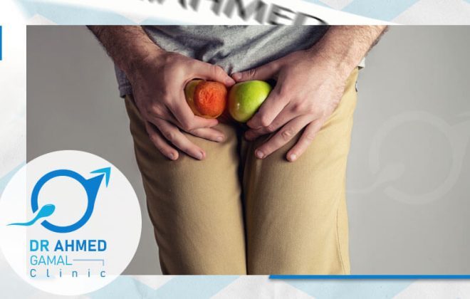 علاج دوالي الخصيتين