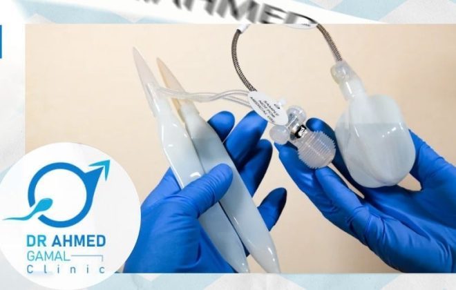نسبة نجاح عملية تركيب دعامة العضو الذكري