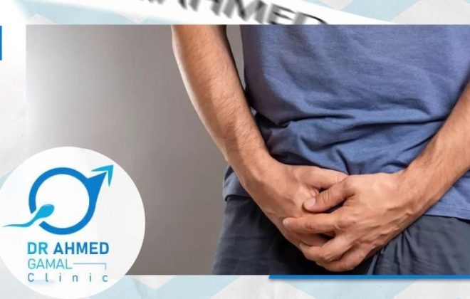 كل ما تحتاج معرفته عن دوالي الخصية